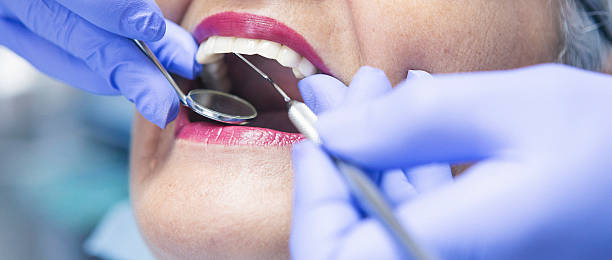 Best Emergency Tooth Extraction in Eldon, MO